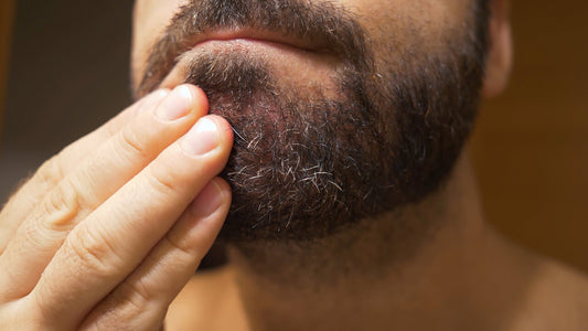 Common Beard Problems and How to Solve Them